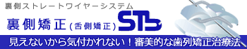 裏側ストレートワイヤーシステム STbネット-見えないから気付かれない！審美的な矯正歯科治療法