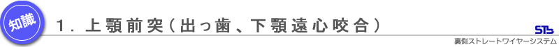 上顎前突（出っ歯、下顎遠心咬合）