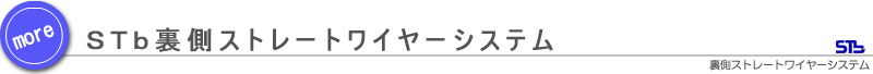 裏側ストレートワイヤーシステム