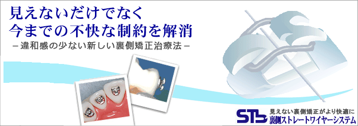 見えないだけでなく今までの不快な制約を解消した違和感の少ない裏側矯正治療法