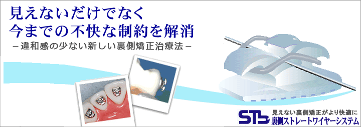 見えないだけでなく今までの不快な制約を解消した違和感の少ない裏側矯正治療法